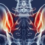 Decoding the Mystery of Si Joint Pain Causes and Symptoms